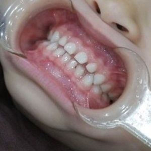 Meet your Posher, Junwoo